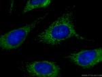 MAVS/VISA Antibody in Immunocytochemistry (ICC/IF)