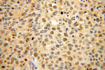 USP1 Antibody in Immunohistochemistry (Paraffin) (IHC (P))