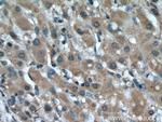 USP1 Antibody in Immunohistochemistry (Paraffin) (IHC (P))