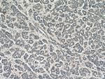 USP1 Antibody in Immunohistochemistry (Paraffin) (IHC (P))