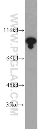 USP1 Antibody in Western Blot (WB)