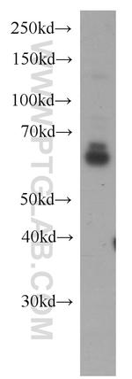 NOX4 Antibody in Western Blot (WB)