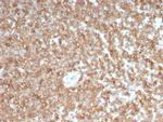 GM-CSF (Granulocyte/Macrophage - Colony Stimulating Factor) Antibody in Immunohistochemistry (Paraffin) (IHC (P))