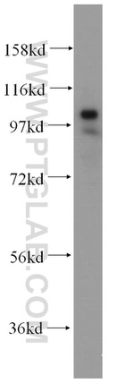 ATP1A1 Antibody in Western Blot (WB)