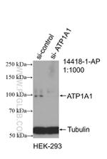 ATP1A1 Antibody in Western Blot (WB)