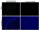 FOXP3 Antibody in Immunohistochemistry (Paraffin) (IHC (P))