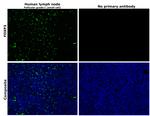 FOXP3 Antibody in Immunohistochemistry (Paraffin) (IHC (P))