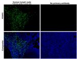 FOXP3 Antibody in Immunohistochemistry (Paraffin) (IHC (P))