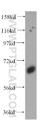 Synaptotagmin-1 Antibody in Western Blot (WB)