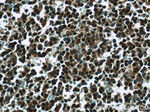 LMP2 Antibody in Immunohistochemistry (Paraffin) (IHC (P))