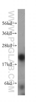 LMP2 Antibody in Western Blot (WB)