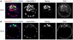 Nanog Antibody in Immunocytochemistry (ICC/IF)