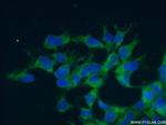 RPL7 Antibody in Immunocytochemistry (ICC/IF)