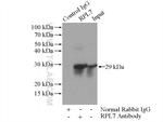 RPL7 Antibody in Immunoprecipitation (IP)