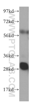 RPL7 Antibody in Western Blot (WB)