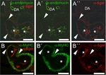 Endomucin Antibody in Immunohistochemistry (IHC)