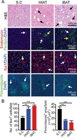 Endomucin Antibody in Immunohistochemistry (Paraffin) (IHC (P))