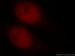 TERF2IP Antibody in Immunocytochemistry (ICC/IF)