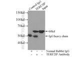 TERF2IP Antibody in Immunoprecipitation (IP)