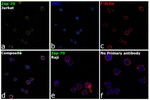 Zap-70 Antibody in Immunocytochemistry (ICC/IF)