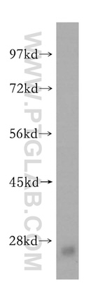 IgG light chain (Kappa) Antibody in Western Blot (WB)