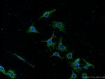 CRMP2 Antibody in Immunocytochemistry (ICC/IF)