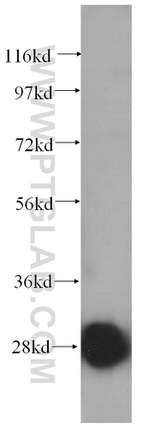 RPS4X Antibody in Western Blot (WB)