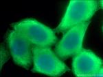 LDHB Antibody in Immunocytochemistry (ICC/IF)