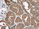 LDHB Antibody in Immunohistochemistry (Paraffin) (IHC (P))