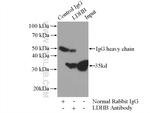 LDHB Antibody in Immunoprecipitation (IP)