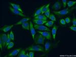 RPL35 Antibody in Immunocytochemistry (ICC/IF)