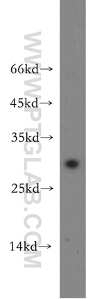 CRISP3 Antibody in Western Blot (WB)