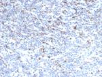 CTLA4/CD152 (Negative Regulator of T-Cells) Antibody in Immunohistochemistry (Paraffin) (IHC (P))