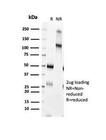 CTLA4/CD152 (Negative Regulator of T-Cells) Antibody in SDS-PAGE (SDS-PAGE)