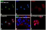 ZEB1 Antibody in Immunocytochemistry (ICC/IF)