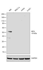 IRF4 Antibody in Western Blot (WB)