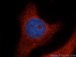 RPL14 Antibody in Immunocytochemistry (ICC/IF)