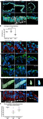 FOXJ1 Antibody in Immunohistochemistry (IHC)