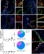 FOXJ1 Antibody in Immunohistochemistry (Paraffin) (IHC (P))