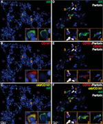 Perforin Antibody in Immunohistochemistry (IHC)
