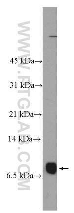 NUPR1 Antibody in Western Blot (WB)