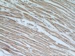 NUDT9 Antibody in Immunohistochemistry (Paraffin) (IHC (P))