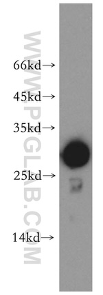 GSTO1 Antibody in Western Blot (WB)
