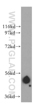 B4GALT4 Antibody in Western Blot (WB)