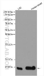 NDUFS5 Antibody in Western Blot (WB)