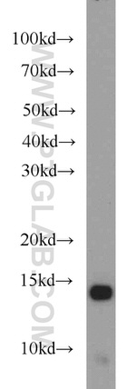 NDUFS5 Antibody in Western Blot (WB)