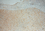 MRPL34 Antibody in Immunohistochemistry (Paraffin) (IHC (P))