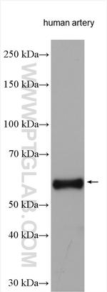 Elastin Antibody in Western Blot (WB)