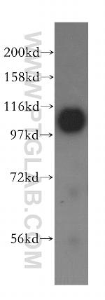 PCDHA5 Antibody in Western Blot (WB)