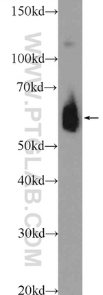 HSP60 Antibody in Western Blot (WB)